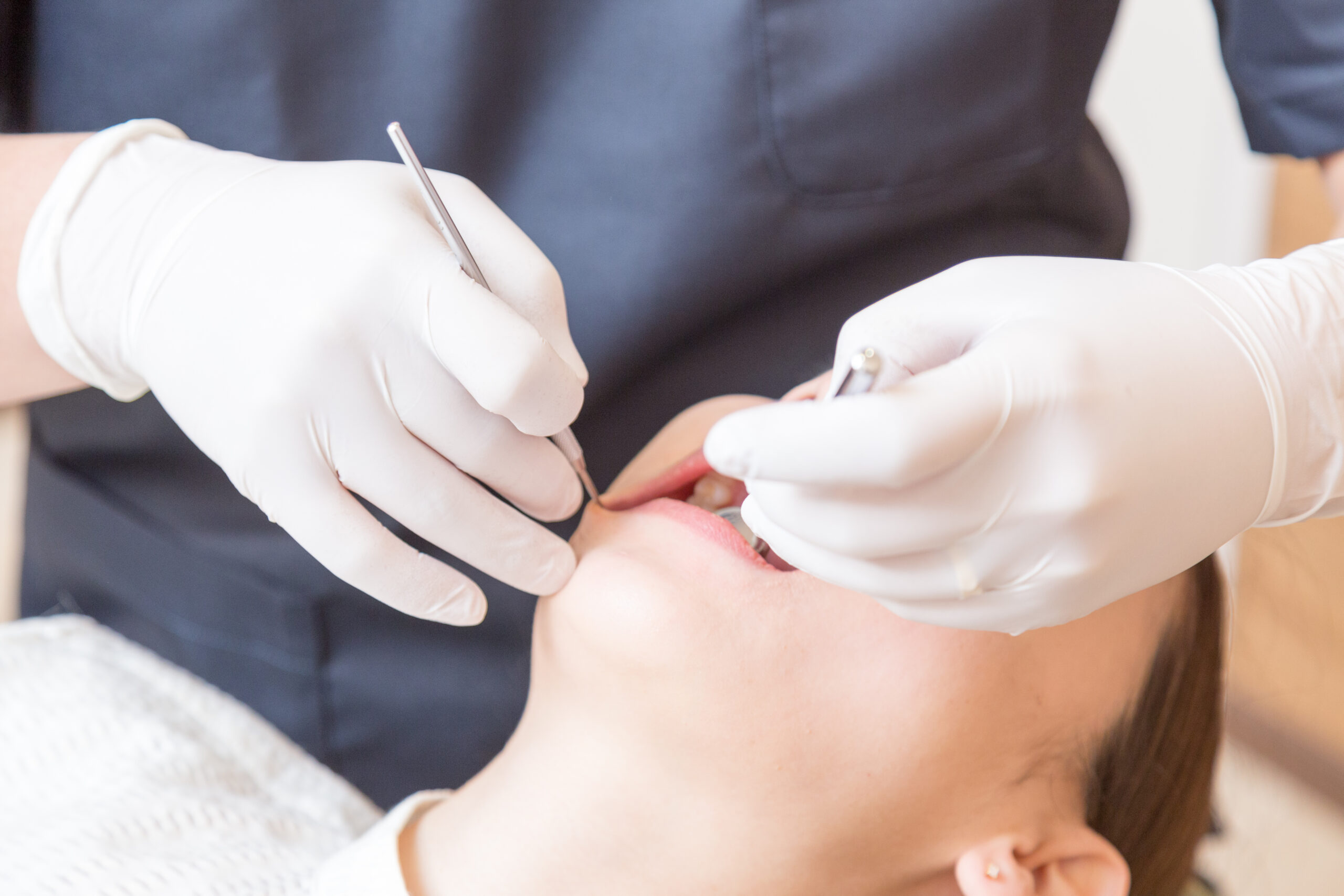 歯茎マッサージを行っています