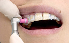 事前クリーニングをしています