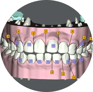 カスタムメイドで精密な矯正