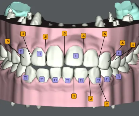 シミュレーション