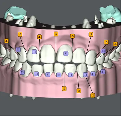 シミュレーション説明
