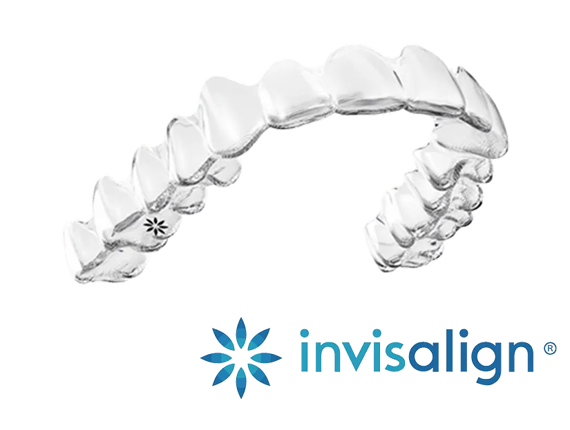 Invisalign Aligner