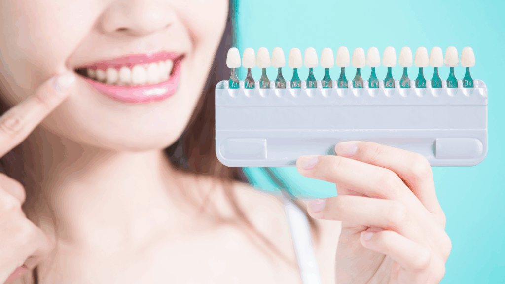 シェードガイド